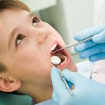 sigillatura-dei-solchi-clinica-dentale
