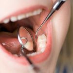 clinica dentale dentini accavallati visita